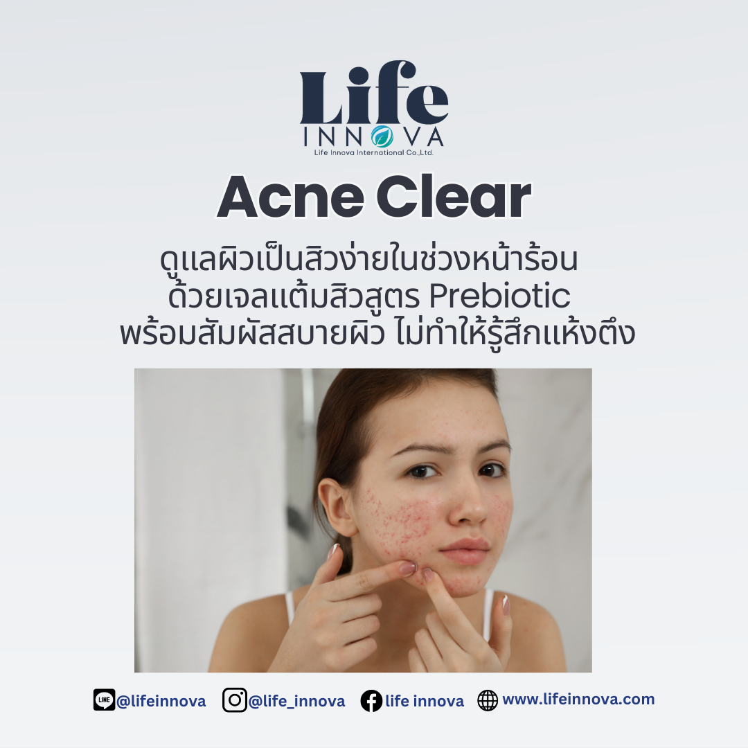 เจลแต้มสิว (Acne Care)